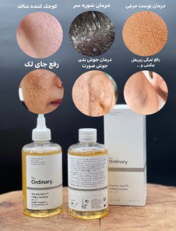  آرایشی و بهداشتی | محصولات پوستی تونر اوردینری